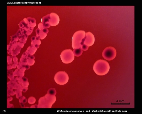 escherichia and klebsiella on Endo agar